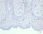 Langerin/CD207 (Marker of Langerhans Cells) Antibody in Immunohistochemistry (Paraffin) (IHC (P))