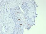 Langerin/CD207 (Marker of Langerhans Cells) Antibody in Immunohistochemistry (Paraffin) (IHC (P))