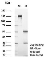 Langerin/CD207 (Marker of Langerhans Cells) Antibody in SDS-PAGE (SDS-PAGE)