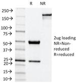 NOX4/NADPH Oxidase 4 Antibody in SDS-PAGE (SDS-PAGE)