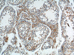 BAX Antibody in Immunohistochemistry (Paraffin) (IHC (P))