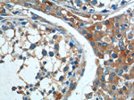 BAX Antibody in Immunohistochemistry (Paraffin) (IHC (P))