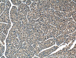 BAX Antibody in Immunohistochemistry (Paraffin) (IHC (P))