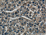 BAX Antibody in Immunohistochemistry (Paraffin) (IHC (P))