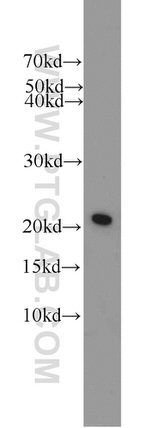 BAX Antibody in Western Blot (WB)