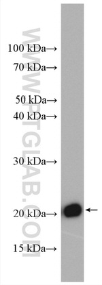 BAX Antibody in Western Blot (WB)