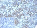 PAX3 Antibody in Immunohistochemistry (Paraffin) (IHC (P))