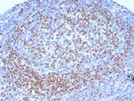 PAX5/BSAP (Early B-Cell Marker) Antibody in Immunohistochemistry (Paraffin) (IHC (P))