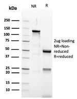 PAX5/BSAP Antibody in SDS-PAGE (SDS-PAGE)