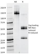 PAX6 Antibody in SDS-PAGE (SDS-PAGE)