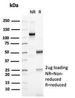 PAX6 (Stem Cell Marker) Antibody in SDS-PAGE (SDS-PAGE)