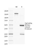 PAX7 (Rhabdomyosarcoma Marker) Antibody in SDS-PAGE (SDS-PAGE)
