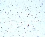 PAX7 (Rhabdomyosarcoma Marker) Antibody in Immunohistochemistry (Paraffin) (IHC (P))