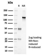 PAX7 (Rhabdomyosarcoma Marker) Antibody in SDS-PAGE (SDS-PAGE)