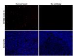 CD223 (LAG-3) Antibody in Immunohistochemistry (Paraffin) (IHC (P))