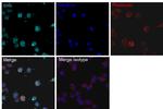 Staphylococcus aureus Cas9 Antibody in Immunocytochemistry (ICC/IF)