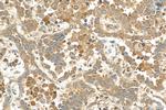 IST1 Antibody in Immunohistochemistry (Paraffin) (IHC (P))