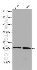 IST1 Antibody in Western Blot (WB)