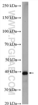 IST1 Antibody in Western Blot (WB)