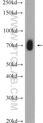 GEFT Antibody in Western Blot (WB)