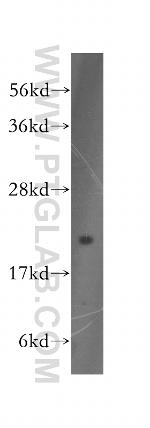 DUSP22 Antibody in Western Blot (WB)