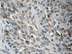 BRD7 Antibody in Immunohistochemistry (Paraffin) (IHC (P))