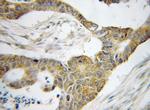 BRD7 Antibody in Immunohistochemistry (Paraffin) (IHC (P))