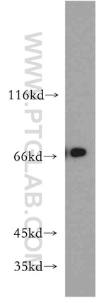 BRD7 Antibody in Western Blot (WB)