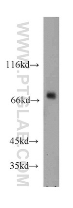 BRD7 Antibody in Western Blot (WB)