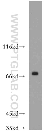 BRD7 Antibody in Western Blot (WB)