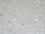 FABP7 Antibody in Immunohistochemistry (Paraffin) (IHC (P))