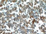 FABP7 Antibody in Immunohistochemistry (Paraffin) (IHC (P))