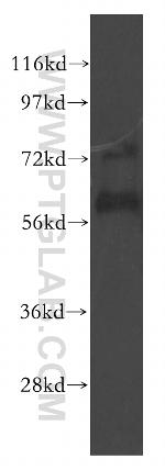 LYVE1 Antibody in Western Blot (WB)