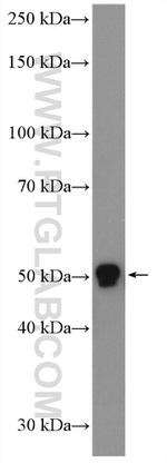 SPTLC2 Antibody in Western Blot (WB)