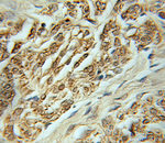 GRHPR Antibody in Immunohistochemistry (Paraffin) (IHC (P))