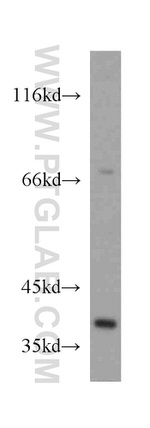 GRHPR Antibody in Western Blot (WB)