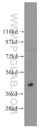 ACOT7L Antibody in Western Blot (WB)