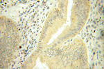 Mecr Antibody in Immunohistochemistry (Paraffin) (IHC (P))