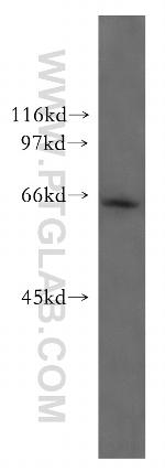 Mecr Antibody in Western Blot (WB)