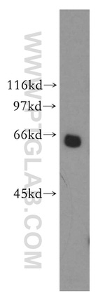 Mecr Antibody in Western Blot (WB)