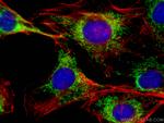 Mecr Antibody in Immunocytochemistry (ICC/IF)