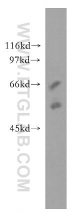 SSTR5 Antibody in Western Blot (WB)