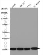 SLC25A6 Antibody in Western Blot (WB)