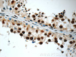 HSF1 Antibody in Immunohistochemistry (Paraffin) (IHC (P))