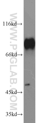 HSF1 Antibody in Western Blot (WB)