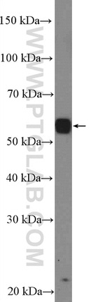 PAX3 Antibody in Western Blot (WB)