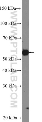 PAX3 Antibody in Western Blot (WB)