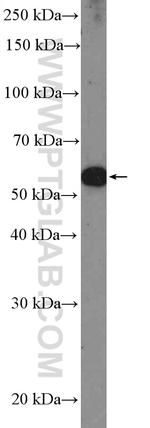 PAX3 Antibody in Western Blot (WB)