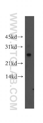 Connexin-26 Antibody in Western Blot (WB)