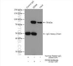 DDX4/VASA Antibody in Immunoprecipitation (IP)